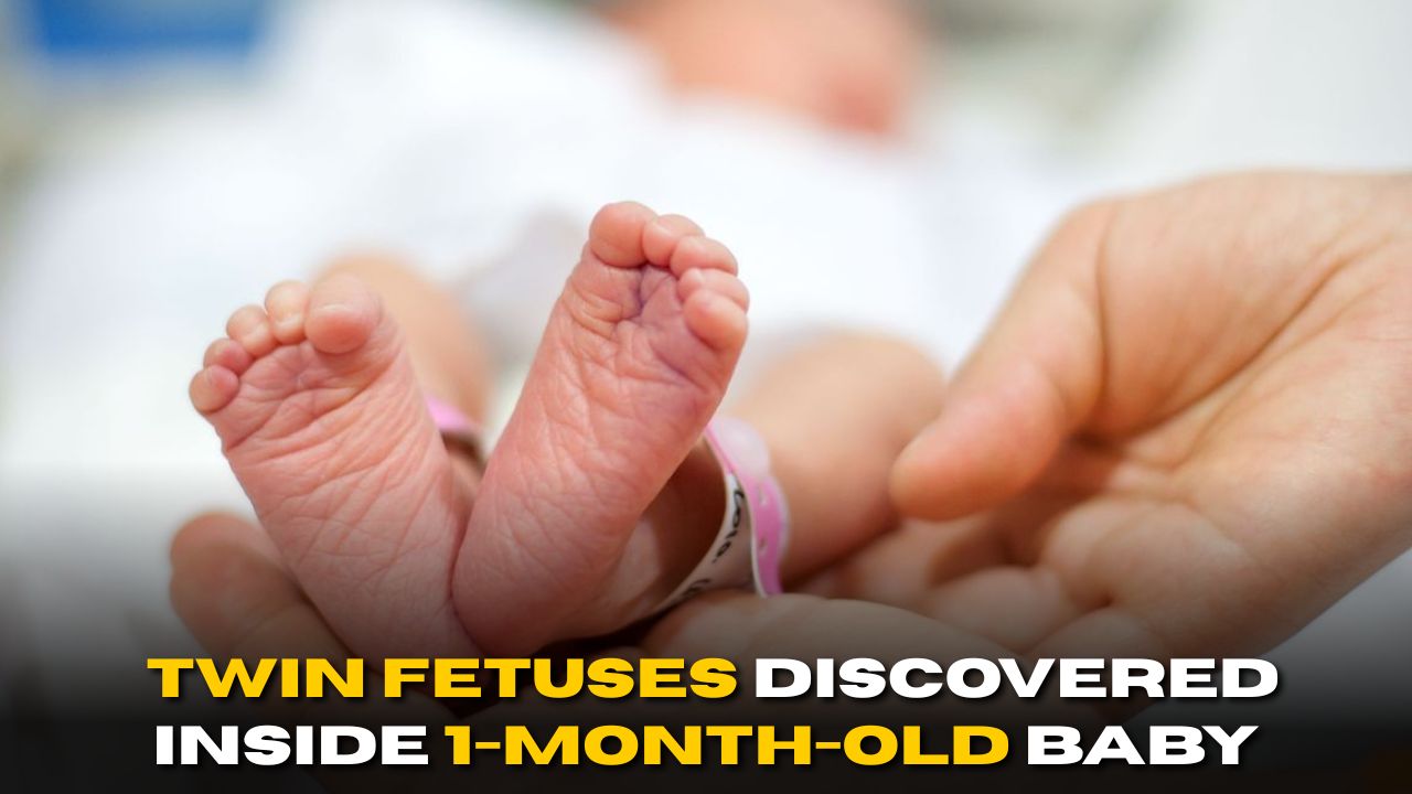 SHOCKING: Twin Fetuses Discovered Inside 1-Month-Old Baby’s Belly