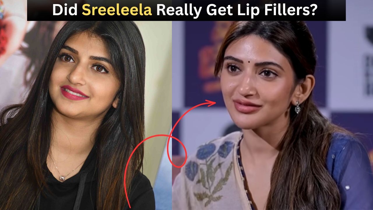 Did Sreeleela Really Get Lip Fillers? Here’s What We Know Did Sreeleela Really Get Lip Fillers? Here’s What We Know