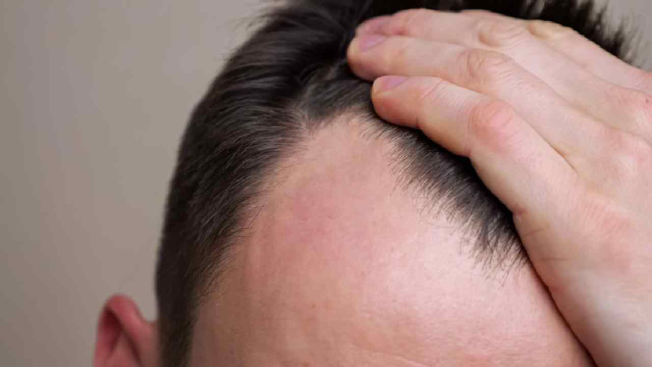 Hair Regrowth in 20 Days? What Taiwan Scientists Have Discovered Hair Regrowth in 20 Days? What Taiwan Scientists Have Discovered