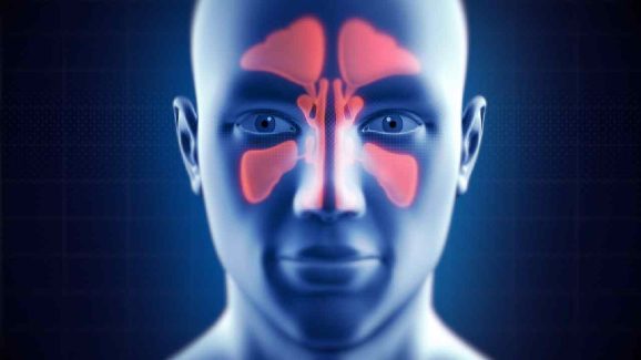 Sinus Problem in Winter: Symptoms and Remedies You Should Know