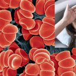 Low Platelets? These Foods Can Be Dangerous, Beware