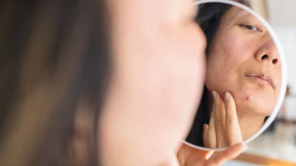 How Air Pollution Silently Ages Your Skin, Expert Tips For Damage Control