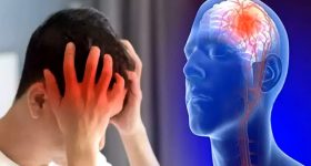 Why Does a Brain Stroke Occur Every 40 Seconds? Ayurveda Remedies to Stay Safe