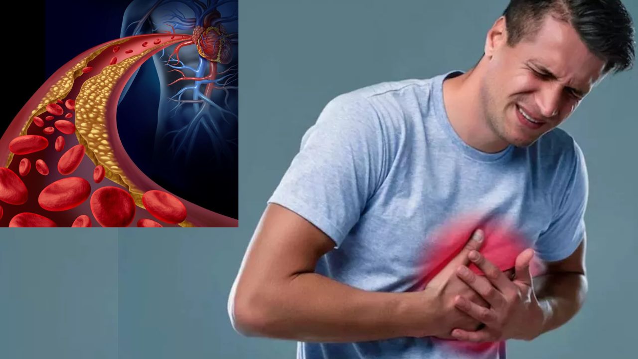 Warning Signs of High Cholesterol You Might Be Ignoring