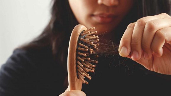 Top 6 Natural Remedies for Hair Fall You Can Try Today