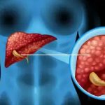 Does Your Blood Group Affect Liver Health? Shocking Findings Inside