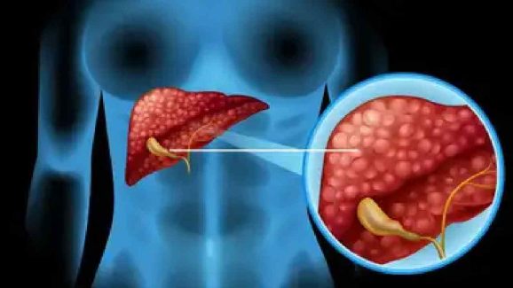 Does Your Blood Group Affect Liver Health? Shocking Findings Inside