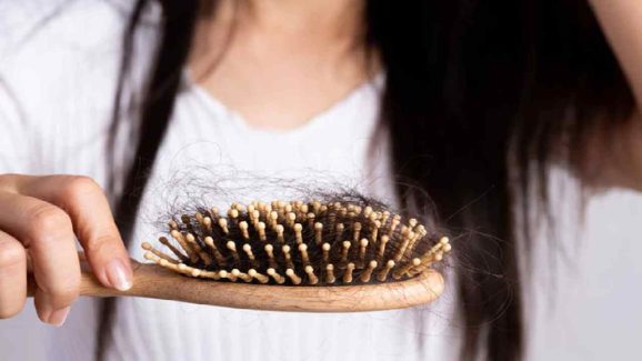 Hair Fall Treatment: Simple and Natural Tips to Reduce Hair Loss
