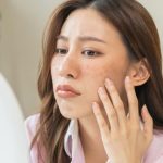 8 Signs Your Skin Barrier Is Damaged: How to Fix It