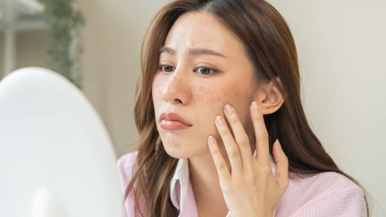 8 Signs Your Skin Barrier Is Damaged: How to Fix It