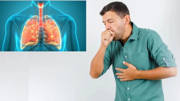 Weak Lungs Alert! Know Symptoms and Ayurvedic Ways to Strengthen Them