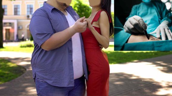Love Turns Tragic: Man Dies After Weight-Loss Surgery To Impress Girlfriend Family