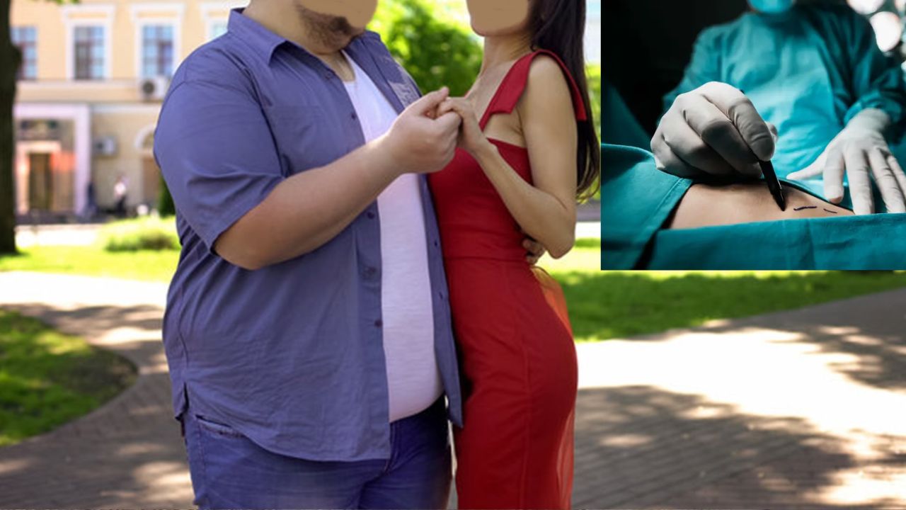 Love Turns Tragic: Man Dies After Weight-Loss Surgery To Impress Girlfriend Family