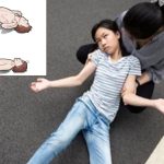 How Often Do Epilepsy Seizures Occur and Which Organ is Most Affected?