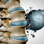Include This Food in Your Diet to Strengthen Your Bones
