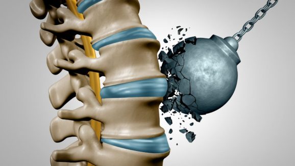 Include This Food in Your Diet to Strengthen Your Bones