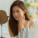 8 Acne Triggers in Winter You Never Noticed: How To Fix Them?
