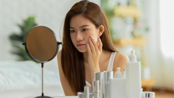 8 Acne Triggers in Winter You Never Noticed: How To Fix Them?