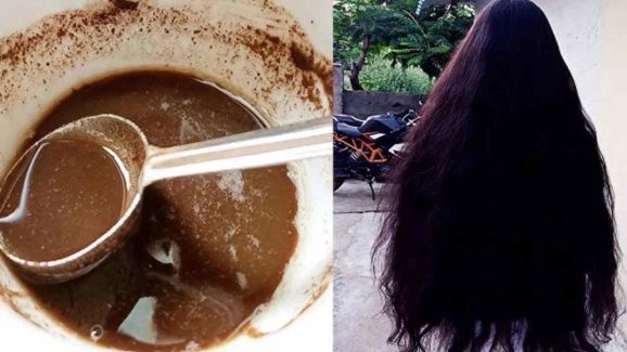 Stop Grey Hair: Simple Home Remedy With Amla Powder and Coconut Oil