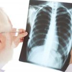 Doctors Reveals Real Cause Of High Pneumonia Cases This Winter