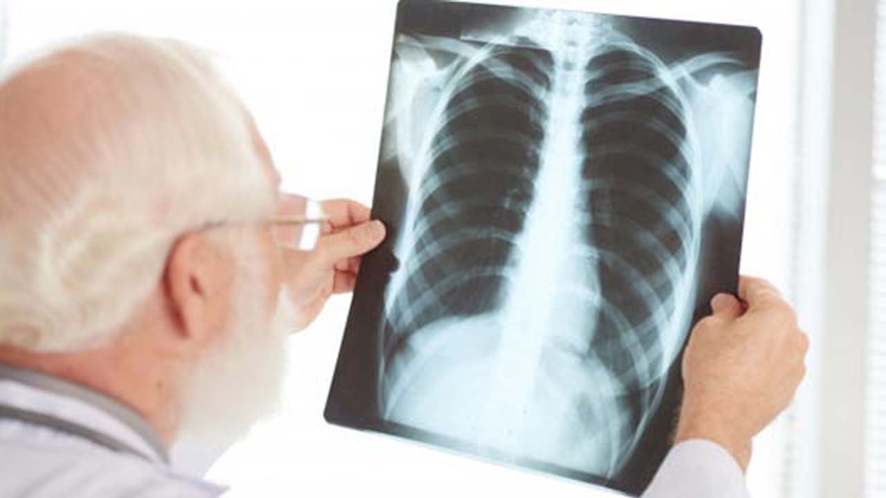 Doctors Reveals Real Cause Of High Pneumonia Cases This Winter