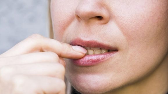 Lip Sleeping Mask vs Lip Oil: Which Prevents Winter Chapping Better?