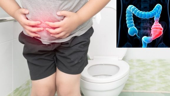 Best Nighttime Foods To Clean Your Stomach In The Morning
