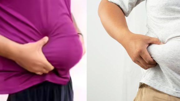 Which Vitamin Deficiency Causes Weight Gain? Here’s How to Correct It