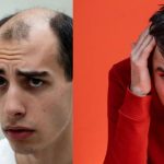 Male Hair Loss Could End: Simple Drug Shows 500% Improvement